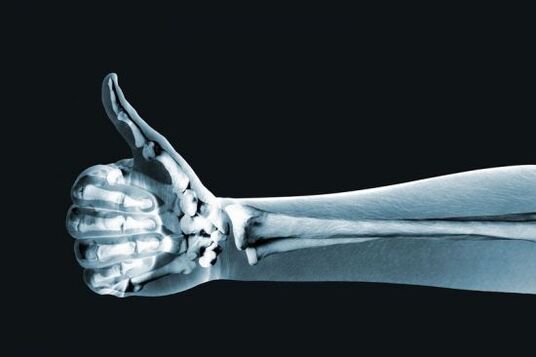 X-rays can be used to diagnose pain in the joints of the fingers