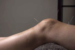 Acupuncture helps to repair joint tissue