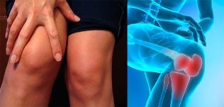 Discomfort and swelling of the knee are the first symptoms of arthrosis