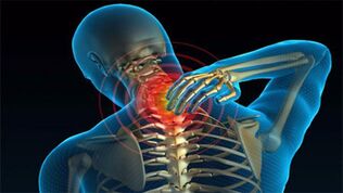 causes of osteochondrosis of the neck